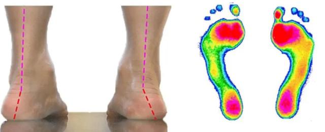足部结构图和名称清晰（足部结构图高清）